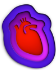 What is pericarditis?