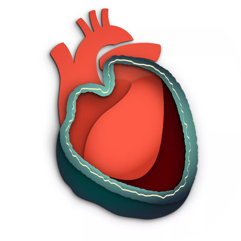 Constrictive pericarditis graphic